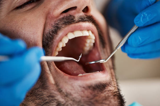Best Walk-In Emergency Dentist in Bonnie Brae, IL